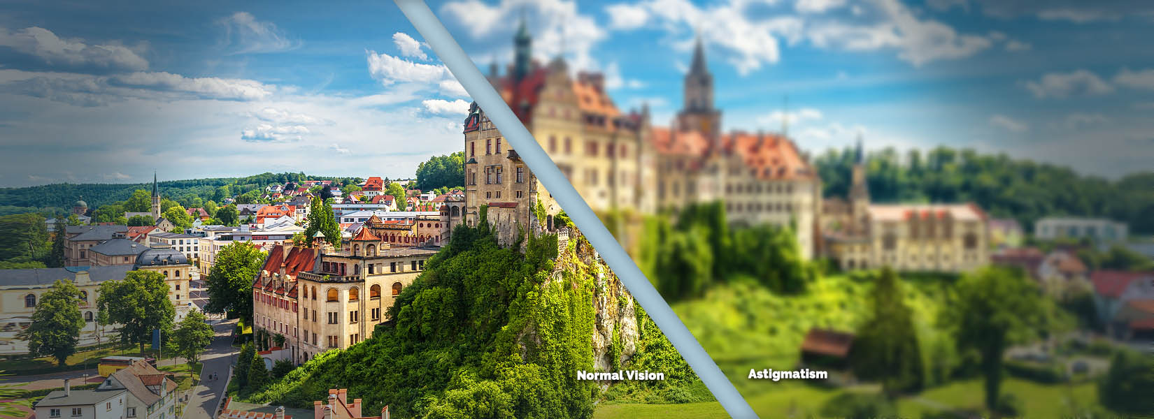 Astigmatism Treatment in Willowbrook